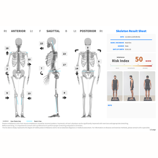 Moti Physio® 3D 靜態與動態姿勢肌肉骨骼掃描報告