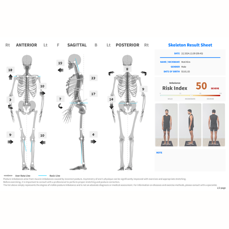 3D Static & Dynamic Posture & Musculoskeletal Scan with Analysis Report Moti Physio®