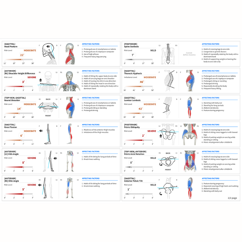 3D Static & Dynamic Posture & Musculoskeletal Scan with Analysis Report Moti Physio®