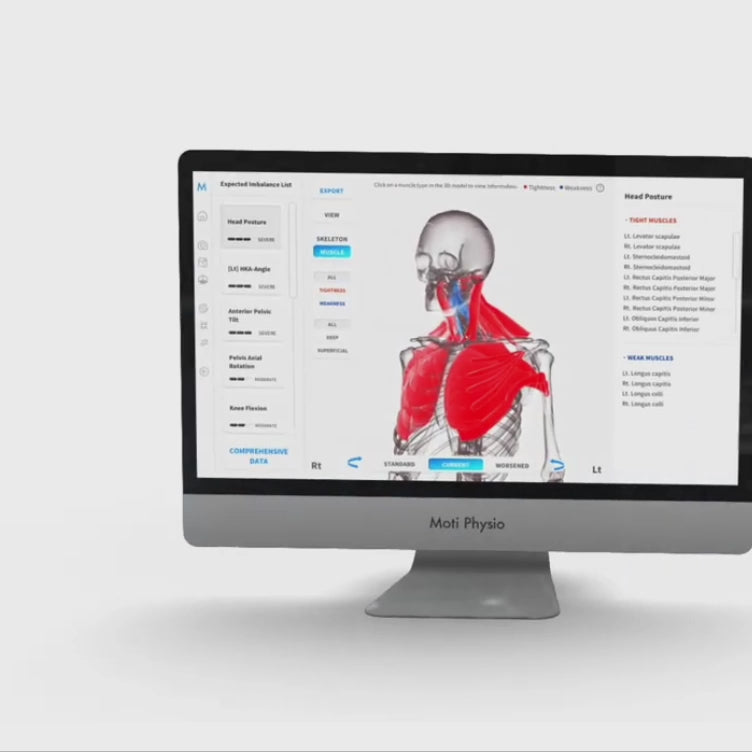 3D Static & Dynamic Posture & Musculoskeletal Scan with Analysis Report Moti Physio®