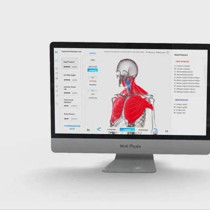 3D Static/Dynamic Posture & Musculoskeletal Scan